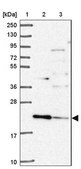 Anti-TMEM11 antibody produced in rabbit Prestige Antibodies&#174; Powered by Atlas Antibodies, affinity isolated antibody, buffered aqueous glycerol solution