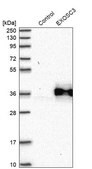 Anti-EXOSC3 antibody produced in rabbit Prestige Antibodies&#174; Powered by Atlas Antibodies, affinity isolated antibody, buffered aqueous glycerol solution