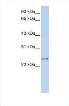 Anti-RCAN3 antibody produced in rabbit affinity isolated antibody