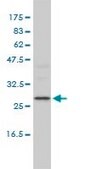 Monoclonal Anti-DEPC-1 antibody produced in mouse clone 2A5-4F5, purified immunoglobulin, buffered aqueous solution