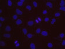 BCR and c-Abl PLA® Antibody Kit Powered by Bethyl Laboratories, Inc.