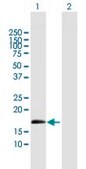 Anti-SUHW4 antibody produced in mouse IgG fraction of antiserum, buffered aqueous solution
