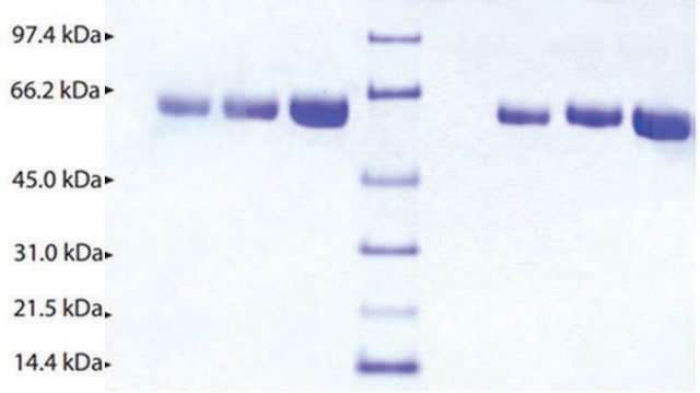 &#945;-2抗纤溶酶 来源于人类血浆 &#8805;95% (SDS-PAGE)