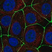 Anti-CLDN3 antibody produced in rabbit Prestige Antibodies&#174; Powered by Atlas Antibodies, affinity isolated antibody, buffered aqueous glycerol solution