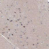 抗-FOXO1 兔抗 Prestige Antibodies&#174; Powered by Atlas Antibodies, affinity isolated antibody, buffered aqueous glycerol solution