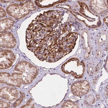 Anti-CYYR1 antibody produced in rabbit Prestige Antibodies&#174; Powered by Atlas Antibodies, affinity isolated antibody, buffered aqueous glycerol solution