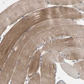 Anti-TRAK1 antibody produced in rabbit Prestige Antibodies&#174; Powered by Atlas Antibodies, affinity isolated antibody, buffered aqueous glycerol solution