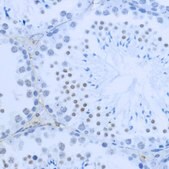Anti-DiMethyl-Histone H3-K36 antibody produced in rabbit