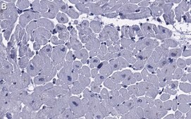 Anti-RHOT1/MIRO-1 Antibody, clone 1F4 ZooMAb&#174; Rabbit Monoclonal recombinant, expressed in HEK 293 cells