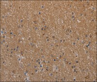 Anti-NAA25 antibody produced in rabbit affinity isolated antibody