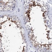 Anti-SPATA7 antibody produced in rabbit Prestige Antibodies&#174; Powered by Atlas Antibodies, affinity isolated antibody, buffered aqueous glycerol solution