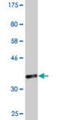 Monoclonal Anti-RPL23A antibody produced in mouse clone 3E11, purified immunoglobulin, buffered aqueous solution