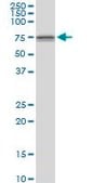 Anti-DDX59 antibody produced in mouse IgG fraction of antiserum, buffered aqueous solution