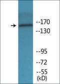 Anti-phospho-FANCA (pSer1149) antibody produced in rabbit affinity isolated antibody
