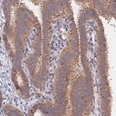 Anti-MIGA2 antibody produced in rabbit Prestige Antibodies® Powered by Atlas Antibodies, affinity isolated antibody, buffered aqueous glycerol solution