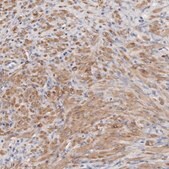 Anti-LMOD1 antibody produced in rabbit Prestige Antibodies&#174; Powered by Atlas Antibodies, affinity isolated antibody, buffered aqueous glycerol solution, ab2