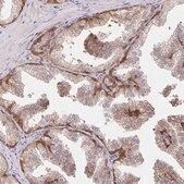 Anti-SORL1 antibody produced in rabbit Prestige Antibodies&#174; Powered by Atlas Antibodies, affinity isolated antibody, buffered aqueous glycerol solution
