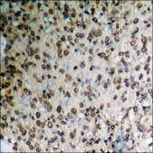Anti-phospho-Androgen Receptor (pTyr363) antibody produced in rabbit affinity isolated antibody