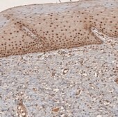 Anti-RECQL5 antibody produced in rabbit Prestige Antibodies&#174; Powered by Atlas Antibodies, affinity isolated antibody, buffered aqueous glycerol solution