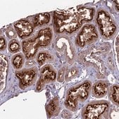 Anti-MFSD8 antibody produced in rabbit Prestige Antibodies&#174; Powered by Atlas Antibodies, affinity isolated antibody, buffered aqueous glycerol solution