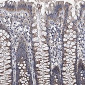 Anti-NRP1 antibody produced in rabbit Prestige Antibodies&#174; Powered by Atlas Antibodies, affinity isolated antibody, buffered aqueous glycerol solution