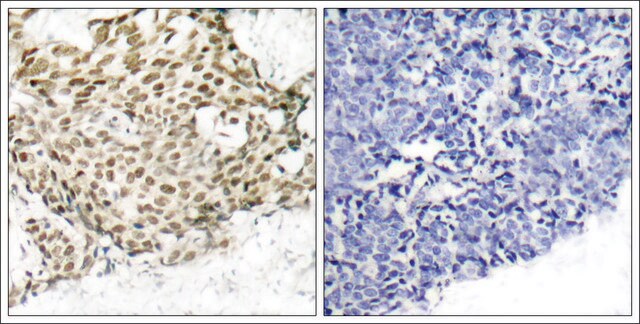 Anti-NBN (Ab-343) antibody produced in rabbit affinity isolated antibody