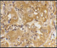 Anti-Bim antibody produced in rabbit affinity isolated antibody, buffered aqueous solution