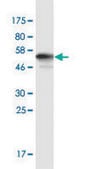 Monoclonal Anti-AKR1CL2 antibody produced in mouse clone 1C8, purified immunoglobulin, buffered aqueous solution