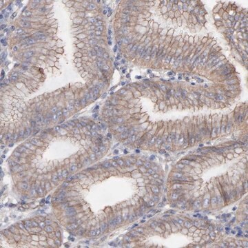 Anti-LRCH2 antibody produced in rabbit Prestige Antibodies&#174; Powered by Atlas Antibodies, affinity isolated antibody, buffered aqueous glycerol solution