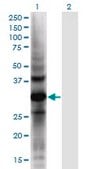 Monoclonal Anti-AKR1CL2 antibody produced in mouse clone 1C8, purified immunoglobulin, buffered aqueous solution