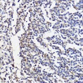 Anti-AKT1 antibody produced in rabbit