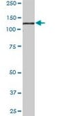 Anti-PKN1 antibody produced in mouse purified immunoglobulin, buffered aqueous solution
