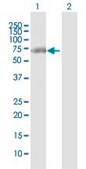 Anti-CTNND1 antibody produced in rabbit purified immunoglobulin, buffered aqueous solution
