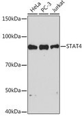 Anti-STAT4 Antibody, clone 10H10O9, Rabbit Monoclonal
