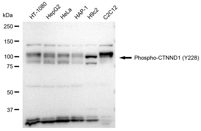 Anti-phospho-CTNND1 (Tyr228) Antibody, clone 23GB3880, Rabbit Monoclonal clone 23GB3880, recombinant rabbit monoclonal, expressed in HEK293 cells