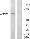 Anti-ZAP-70 antibody produced in rabbit affinity isolated antibody