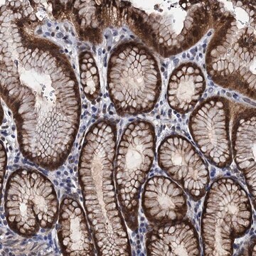 Anti-FAM222A antibody produced in rabbit Prestige Antibodies&#174; Powered by Atlas Antibodies, affinity isolated antibody, buffered aqueous glycerol solution