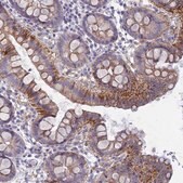 Anti-FERD3L antibody produced in rabbit Prestige Antibodies&#174; Powered by Atlas Antibodies, affinity isolated antibody, buffered aqueous glycerol solution