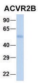 Anti-ACVR2B antibody produced in rabbit affinity isolated antibody