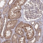 Anti-ABL2 antibody produced in rabbit Prestige Antibodies® Powered by Atlas Antibodies, affinity isolated antibody