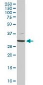 Monoclonal Anti-CDK4, (C-terminal) antibody produced in mouse clone 2G7, purified immunoglobulin, buffered aqueous solution