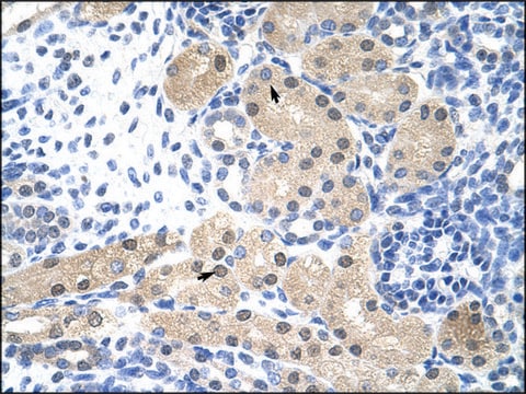 Anti-RNASEH2A antibody produced in rabbit IgG fraction of antiserum