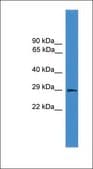 Anti-AQP2 antibody produced in rabbit affinity isolated antibody