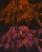 Anti-Ubiquitin Antibody, clone 5Y8J0, Rabbit Monoclonal