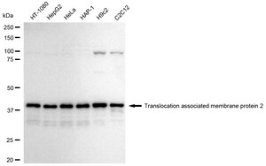 Anti TRAM2 Antibody, clone 24GB1960, Rabbit Monoclonal clone 24GB1960, recombinant rabbit monoclonal, expressed in HEK293 cells