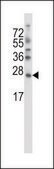 ANTI-SDF2L1 (C-TERM) antibody produced in rabbit IgG fraction of antiserum, buffered aqueous solution
