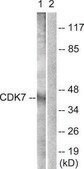 Anti-CDK7 antibody produced in rabbit affinity isolated antibody