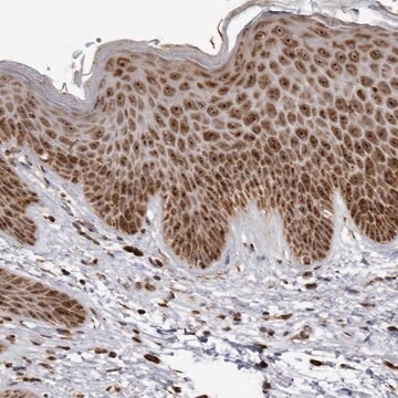 Anti-RBM34 antibody produced in rabbit Prestige Antibodies&#174; Powered by Atlas Antibodies, affinity isolated antibody, buffered aqueous glycerol solution