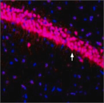 抗-钾通道 Kv4.3 兔抗 affinity isolated antibody, lyophilized powder