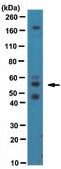 Anti-Katanin-like 1 (KL1) Antibody from rabbit, purified by affinity chromatography